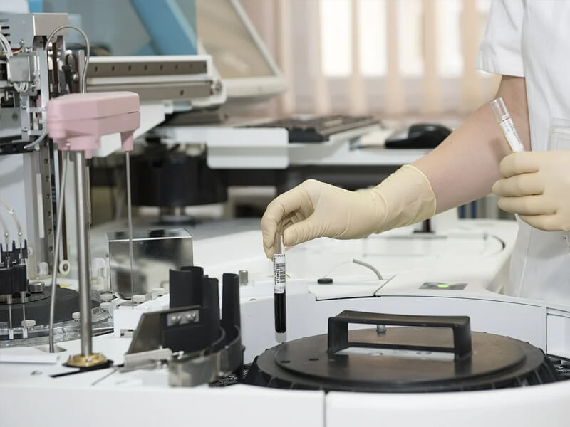 Analyse d'échantillon biologique en laboratoire - Centre CIL Casablanca